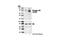 BMX Non-Receptor Tyrosine Kinase antibody, 3211S, Cell Signaling Technology, Western Blot image 