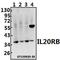 Interleukin 20 Receptor Subunit Beta antibody, A09784-1, Boster Biological Technology, Western Blot image 