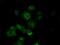 Tubulin Alpha 8 antibody, MA5-25061, Invitrogen Antibodies, Immunocytochemistry image 