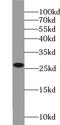 N-Ribosyldihydronicotinamide:Quinone Reductase 2 antibody, abx235831, Abbexa, Western Blot image 