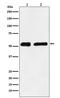 Karyopherin Subunit Alpha 2 antibody, M01776, Boster Biological Technology, Western Blot image 