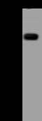 Tripartite Motif Containing 27 antibody, 206942-T32, Sino Biological, Western Blot image 