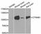 Catenin Beta 1 antibody, STJ23270, St John