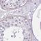 Cyclase Associated Actin Cytoskeleton Regulatory Protein 2 antibody, NBP2-30572, Novus Biologicals, Immunohistochemistry paraffin image 
