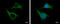 Cytoskeleton Associated Protein 2 antibody, GTX110830, GeneTex, Immunocytochemistry image 