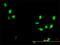 Cyclin Dependent Kinase 1 antibody, H00000983-M01, Novus Biologicals, Immunofluorescence image 