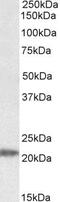 IMP U3 Small Nucleolar Ribonucleoprotein 3 antibody, PA5-19335, Invitrogen Antibodies, Western Blot image 