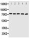 ATP Binding Cassette Subfamily G Member 5 antibody, PA1871, Boster Biological Technology, Western Blot image 