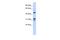 Zinc Finger Protein 765 antibody, A17097, Boster Biological Technology, Western Blot image 