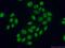 Activating Transcription Factor 2 antibody, 11908-1-AP, Proteintech Group, Immunofluorescence image 