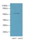 Tripartite Motif Containing 17 antibody, A61494-100, Epigentek, Western Blot image 