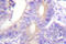 Cbl Proto-Oncogene antibody, LS-C176315, Lifespan Biosciences, Immunohistochemistry paraffin image 