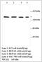 NPC1 Like Intracellular Cholesterol Transporter 1 antibody, MBS416874, MyBioSource, Western Blot image 