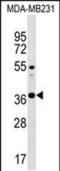 Chymotrypsinogen B1 antibody, PA5-49154, Invitrogen Antibodies, Western Blot image 