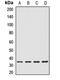 Interleukin 20 Receptor Subunit Beta antibody, orb412670, Biorbyt, Western Blot image 