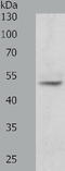 Telomeric repeat-binding factor 1 antibody, TA322886, Origene, Western Blot image 