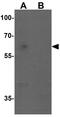 Coactivator Associated Arginine Methyltransferase 1 antibody, GTX31871, GeneTex, Western Blot image 