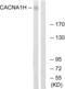 Calcium Voltage-Gated Channel Subunit Alpha1 H antibody, abx015003, Abbexa, Western Blot image 