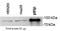 Phosphoinositide-3-Kinase Regulatory Subunit 2 antibody, GTX74710, GeneTex, Western Blot image 