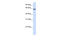 hMATE-2 antibody, ARP51904_P050, Aviva Systems Biology, Western Blot image 