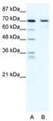 PR/SET Domain 1 antibody, TA335184, Origene, Western Blot image 