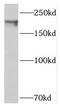 Signal Induced Proliferation Associated 1 Like 1 antibody, FNab07873, FineTest, Western Blot image 