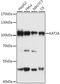 Histone acetyltransferase KAT2A antibody, 18-583, ProSci, Western Blot image 