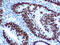 MutL Homolog 1 antibody, GTX14206, GeneTex, Immunohistochemistry paraffin image 