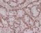 MutL Homolog 1 antibody, M00126, Boster Biological Technology, Immunohistochemistry paraffin image 