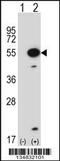 MAPK Activated Protein Kinase 5 antibody, LS-C164477, Lifespan Biosciences, Western Blot image 