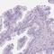 Myomesin 1 antibody, HPA014305, Atlas Antibodies, Immunohistochemistry frozen image 