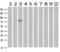 Cadherin 13 antibody, GTX84697, GeneTex, Western Blot image 