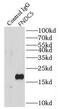 Irisin antibody, FNab03178, FineTest, Immunoprecipitation image 