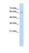 EEF1A Lysine And N-Terminal Methyltransferase antibody, NBP1-55484, Novus Biologicals, Western Blot image 