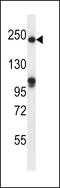 Slit Guidance Ligand 1 antibody, LS-B9620, Lifespan Biosciences, Western Blot image 