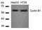 Cyclin-dependent kinase inhibitor 2A, isoform 1 antibody, orb11201, Biorbyt, Western Blot image 