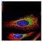 Ribosome Binding Protein 1 antibody, NBP1-32813, Novus Biologicals, Immunofluorescence image 