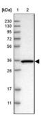 Golgi to ER traffic protein 4 homolog antibody, NBP1-86732, Novus Biologicals, Western Blot image 