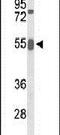 Growth Factor Receptor Bound Protein 7 antibody, PA5-26480, Invitrogen Antibodies, Western Blot image 