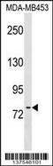 Protein O-Mannosyltransferase 2 antibody, 59-147, ProSci, Western Blot image 