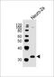 Engrailed Homeobox 2 antibody, 62-925, ProSci, Western Blot image 