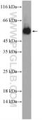 Norrin Cystine Knot Growth Factor NDP antibody, 15380-1-AP, Proteintech Group, Western Blot image 