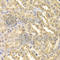 Cyclin Dependent Kinase 9 antibody, A1564, ABclonal Technology, Immunohistochemistry paraffin image 