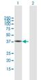 Fatty Acid 2-Hydroxylase antibody, H00079152-B01P, Novus Biologicals, Western Blot image 