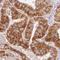 Abhydrolase Domain Containing 11 antibody, HPA049641, Atlas Antibodies, Immunohistochemistry frozen image 