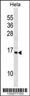 Ribosomal Protein S14 antibody, 58-225, ProSci, Western Blot image 