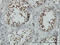 Tousled Like Kinase 1 antibody, LS-C133607, Lifespan Biosciences, Immunohistochemistry frozen image 