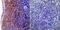 Intercellular Adhesion Molecule 1 antibody, MA5407, Invitrogen Antibodies, Immunohistochemistry frozen image 