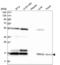 Ubiquitin-conjugating enzyme E2 C antibody, NBP2-56693, Novus Biologicals, Western Blot image 
