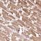 Inositol Polyphosphate-4-Phosphatase Type II B antibody, NBP1-85883, Novus Biologicals, Immunohistochemistry paraffin image 